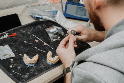Prothèses dentaires fabriquées en Chine : ce que votre dentiste doit vous dire avant de poser une couronne